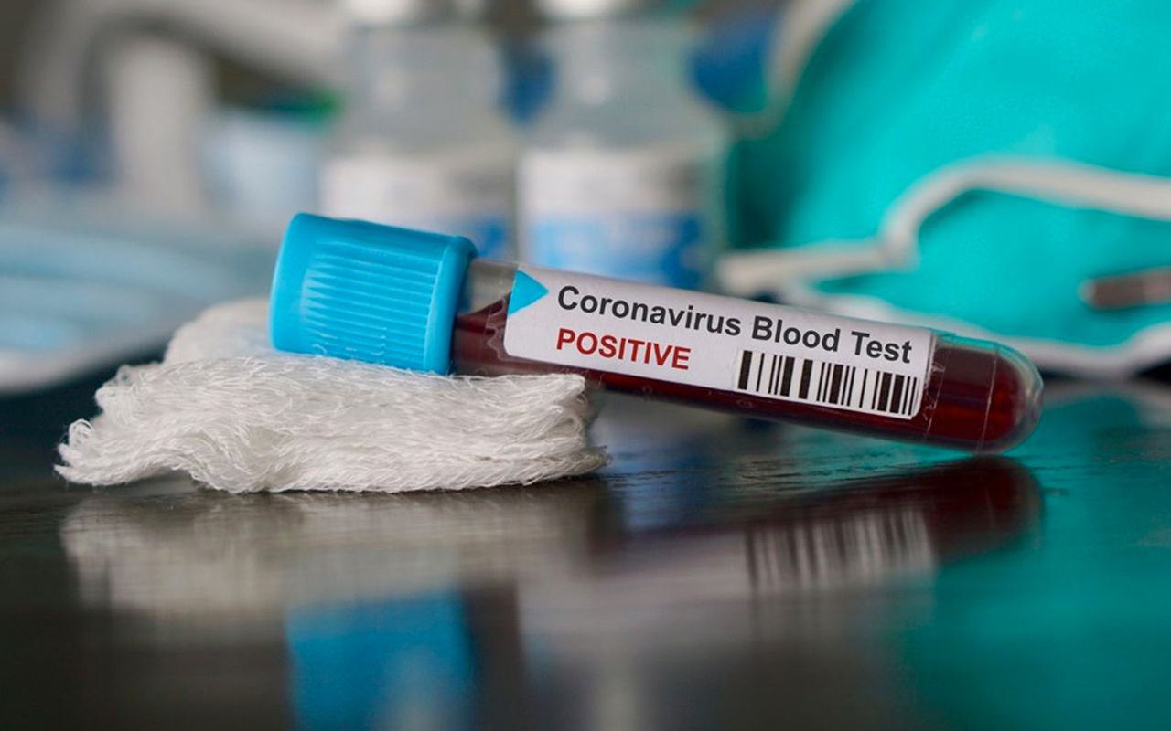 Avustralyalı ve İngiliz bilim insanları corona virüsün ilacını buldu