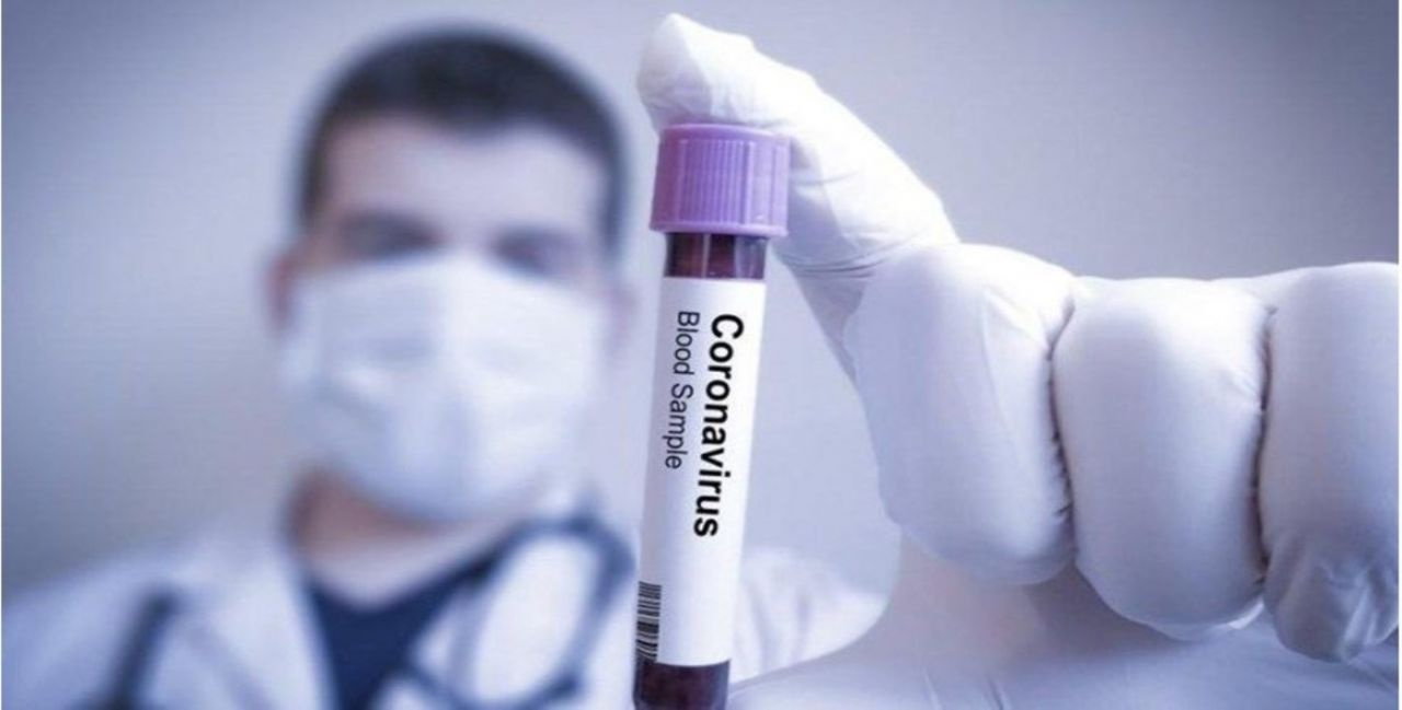 Koronavirüs testi hangi hastanelerde ücretsiz Sağlık Bakanlığı listeyi yayınladı