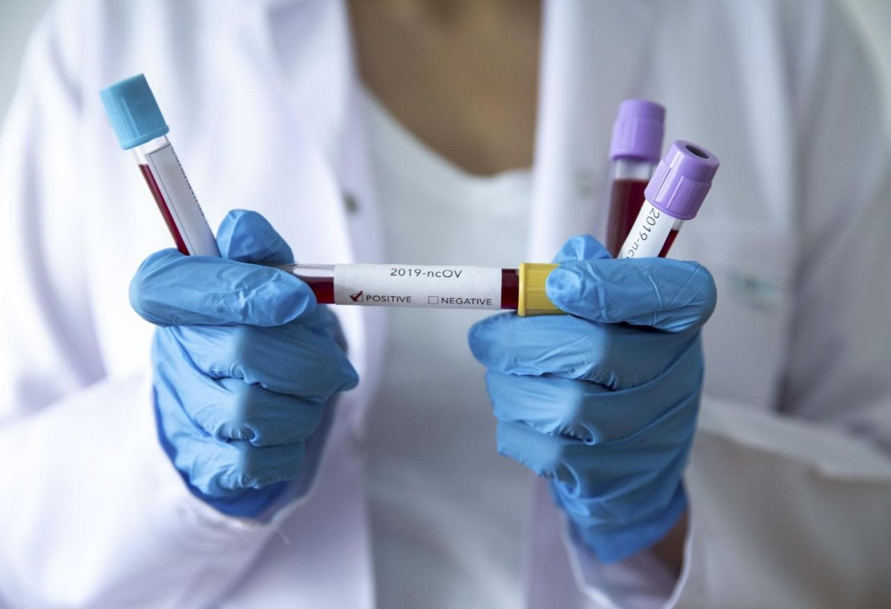 Koronavirüs testi hangi hastanelerde ücretsiz Sağlık Bakanlığı listeyi yayınladı