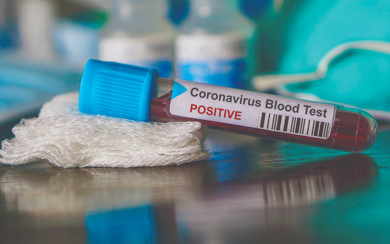 Sürü bağışıklığı nedir Koronavirüs ne zaman bitecek?