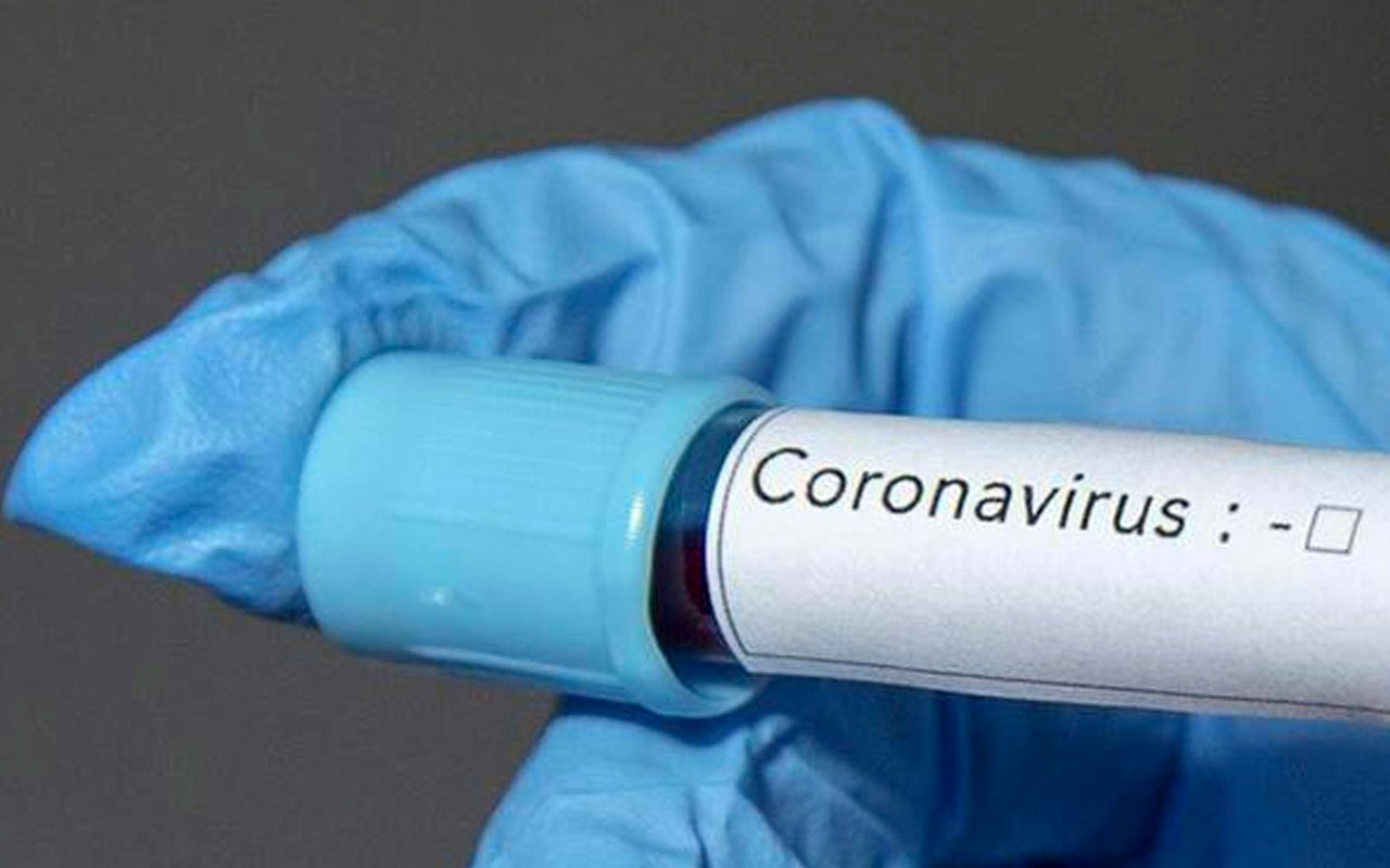 Koronavirüs tedavisinde kullanılan immün plazma teminine ilişkin açıklama