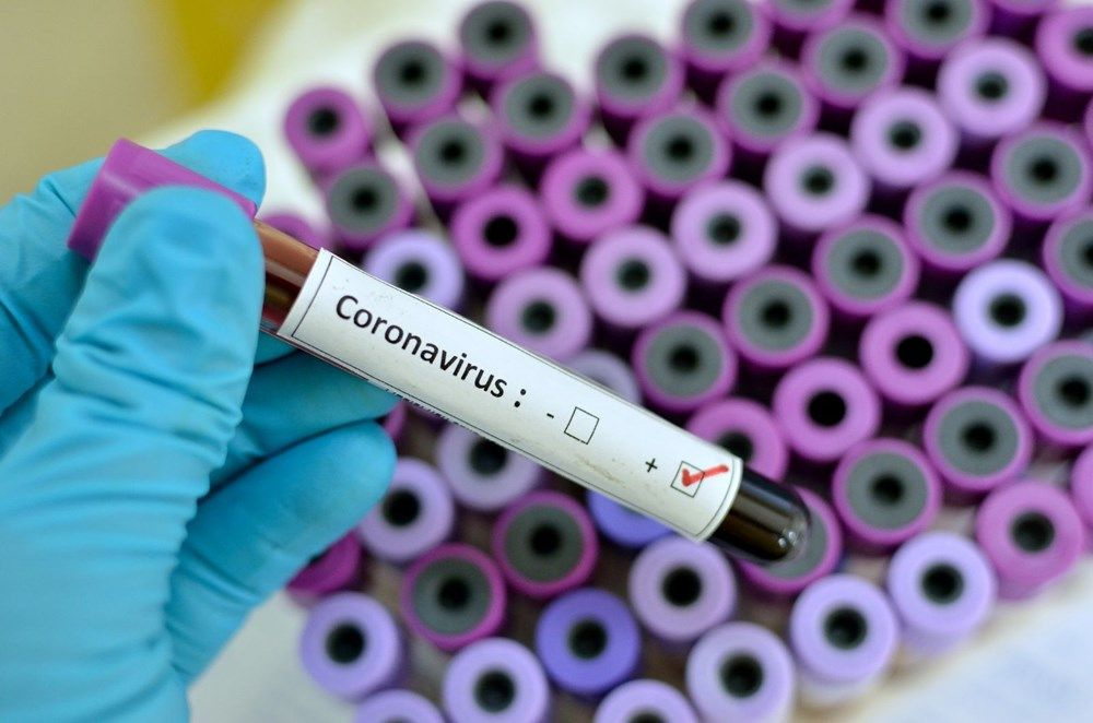 Osman Müftüoğlu yazdı: Koronavirüs bize neler öğretti?