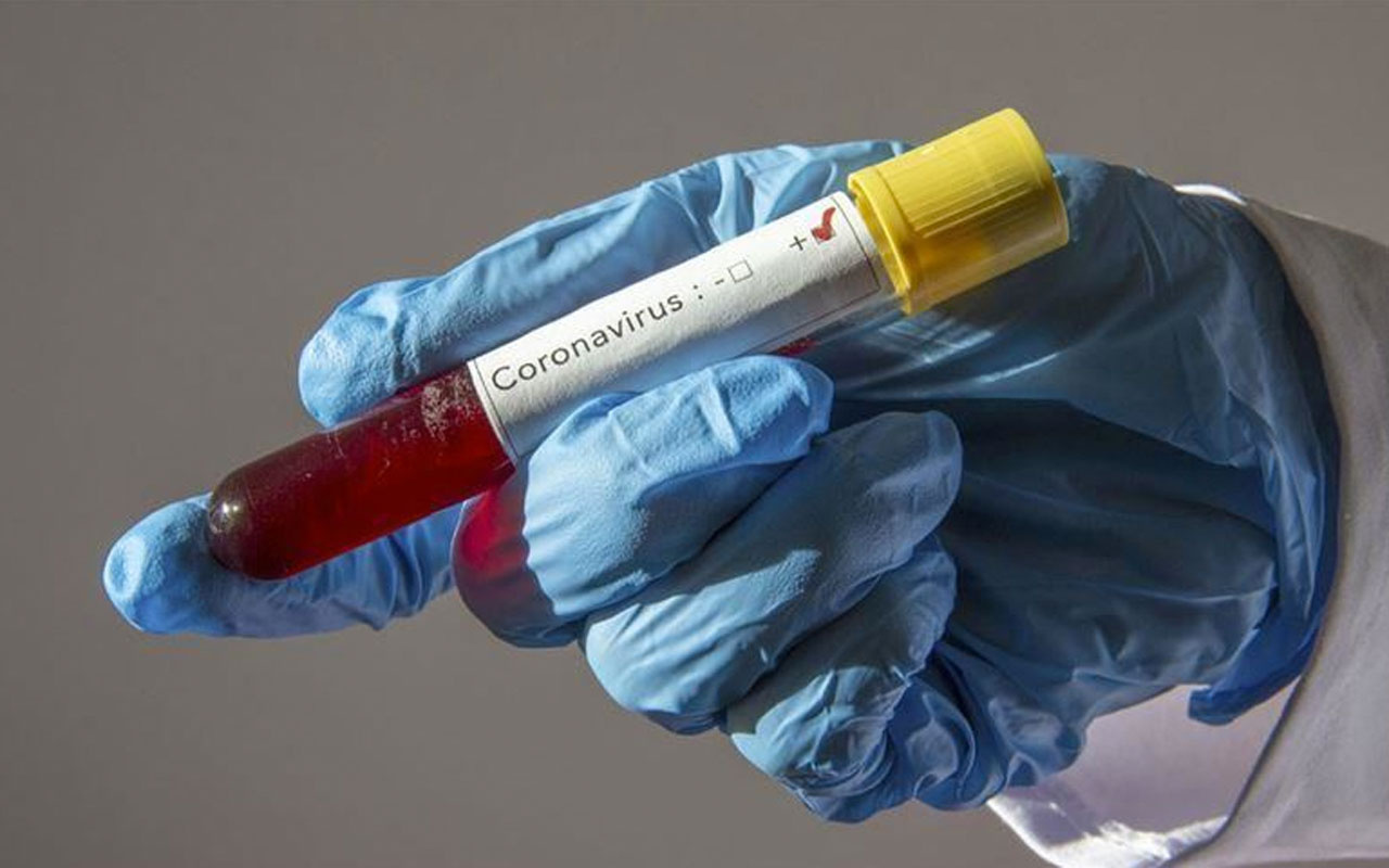 Van'da koronavirüsü yenen 4 hasta taburcu oldu