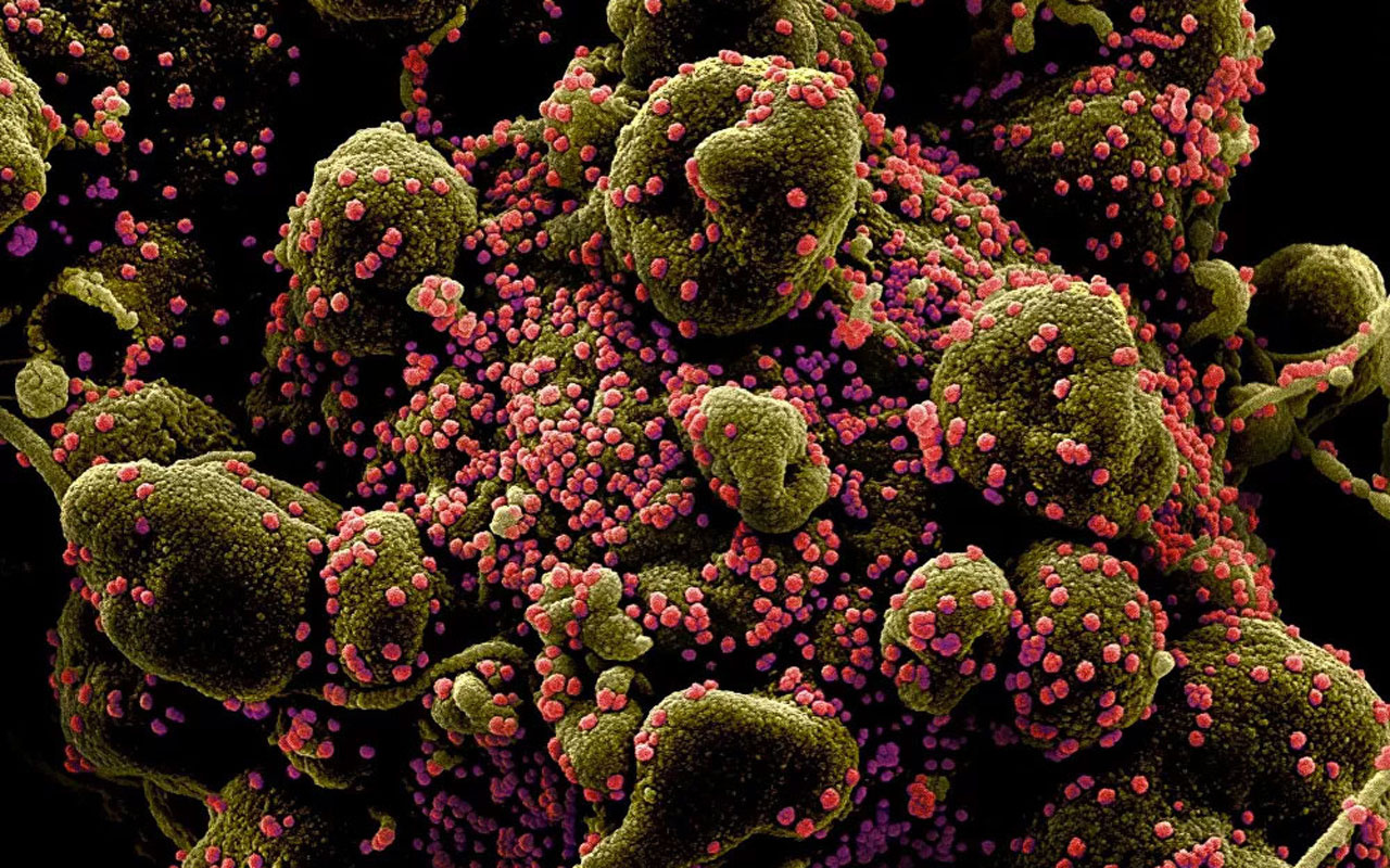 Koronavirüsün insan hücrelerinde yayılışı görüntülendi! Bu ne hız böyle