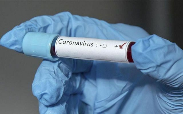 Dünyada koronavirüsten iyileşenlerin sayısı 370 bini aştı