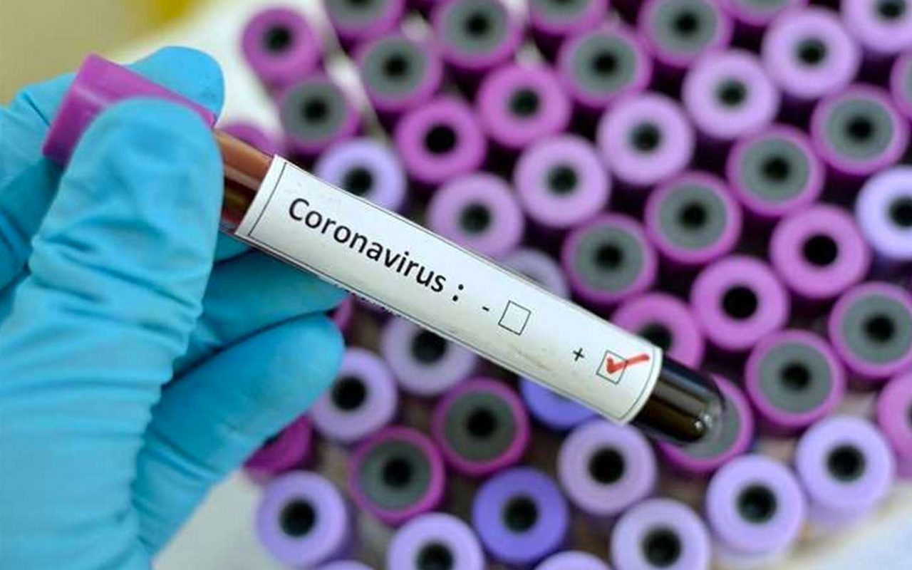Koronavirüs cinsel yolla da bulaşıyor Çinli bilim insanlarının korkutan araştırması