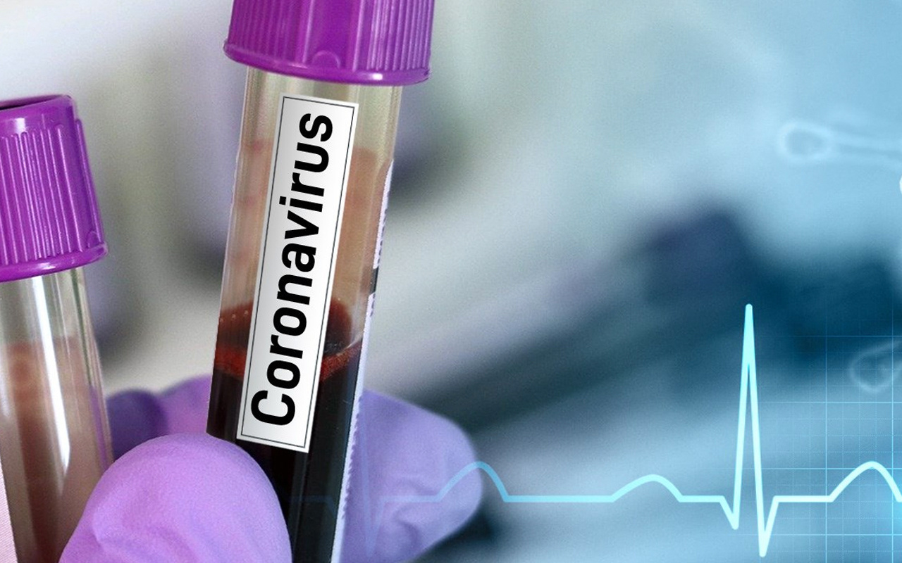 Coronavirüs vaka sayısında Türkiye için bir iyi bir kötü haber