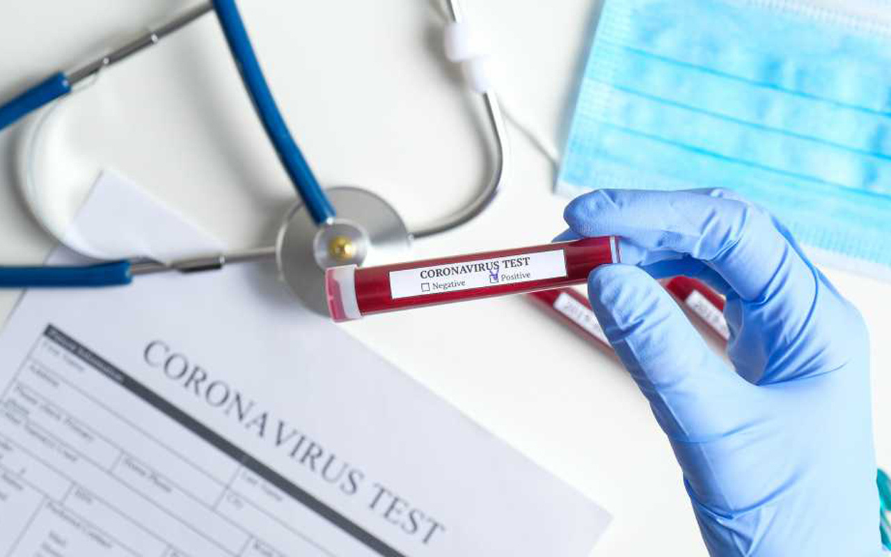 Ürperten itiraf! Ünlü ilaç şirketi: Koronavirüs testleri beş para etmezler