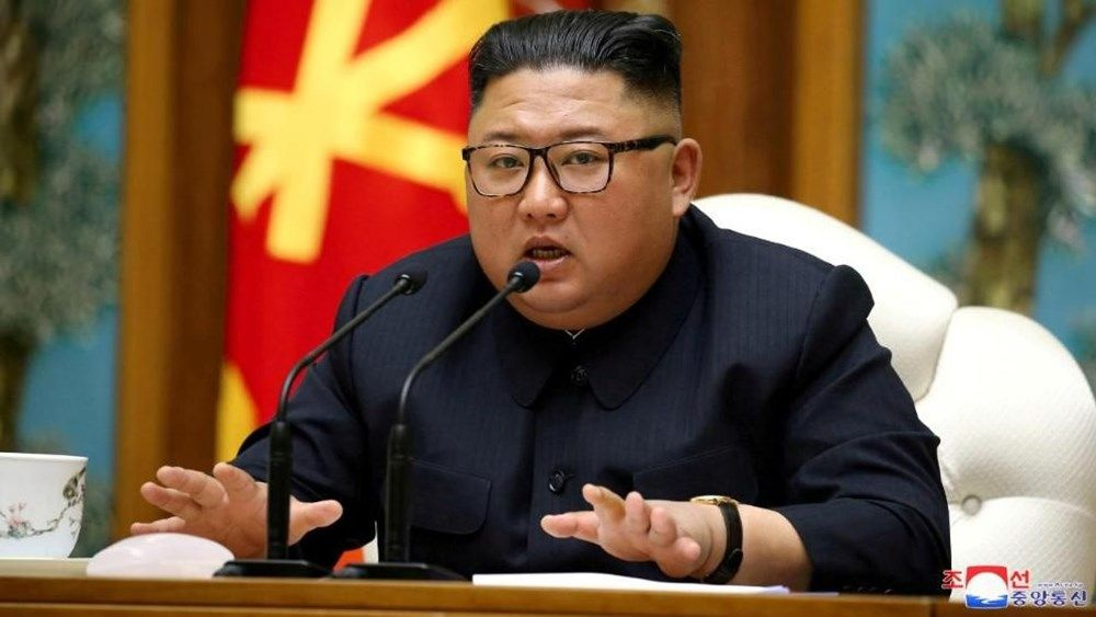 Ölümle pençeleşen Kim Jong-un'un ameliyatıla ilgili bomba detaylar ortaya çıktı