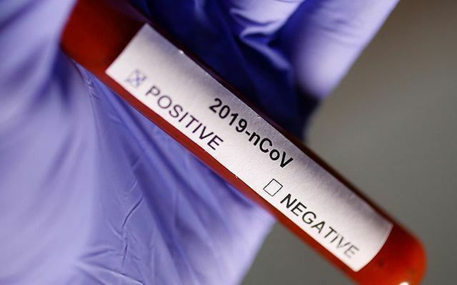 Dünya genelinde koronavirüs salgınında son durum