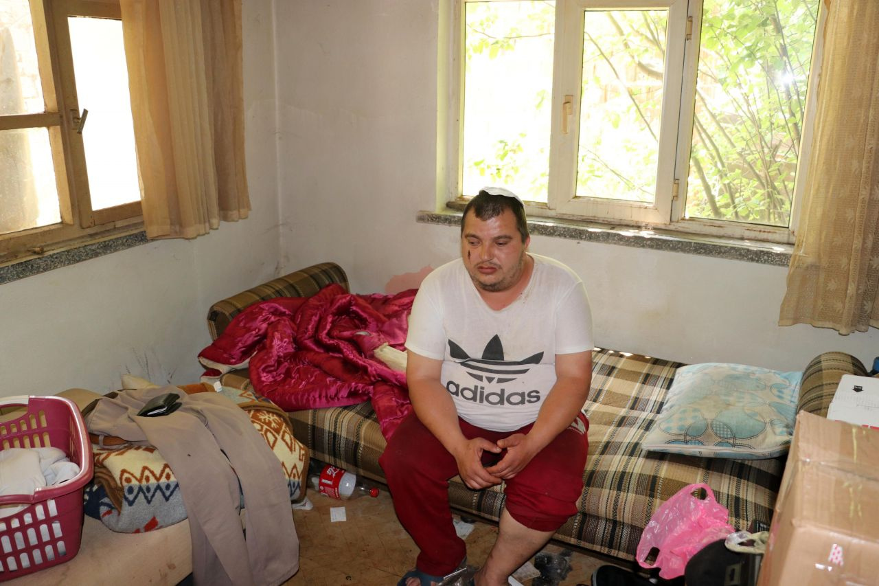 Edirne'de ev sahibinin dayak attığı engelli Sercan yardım bekliyor
