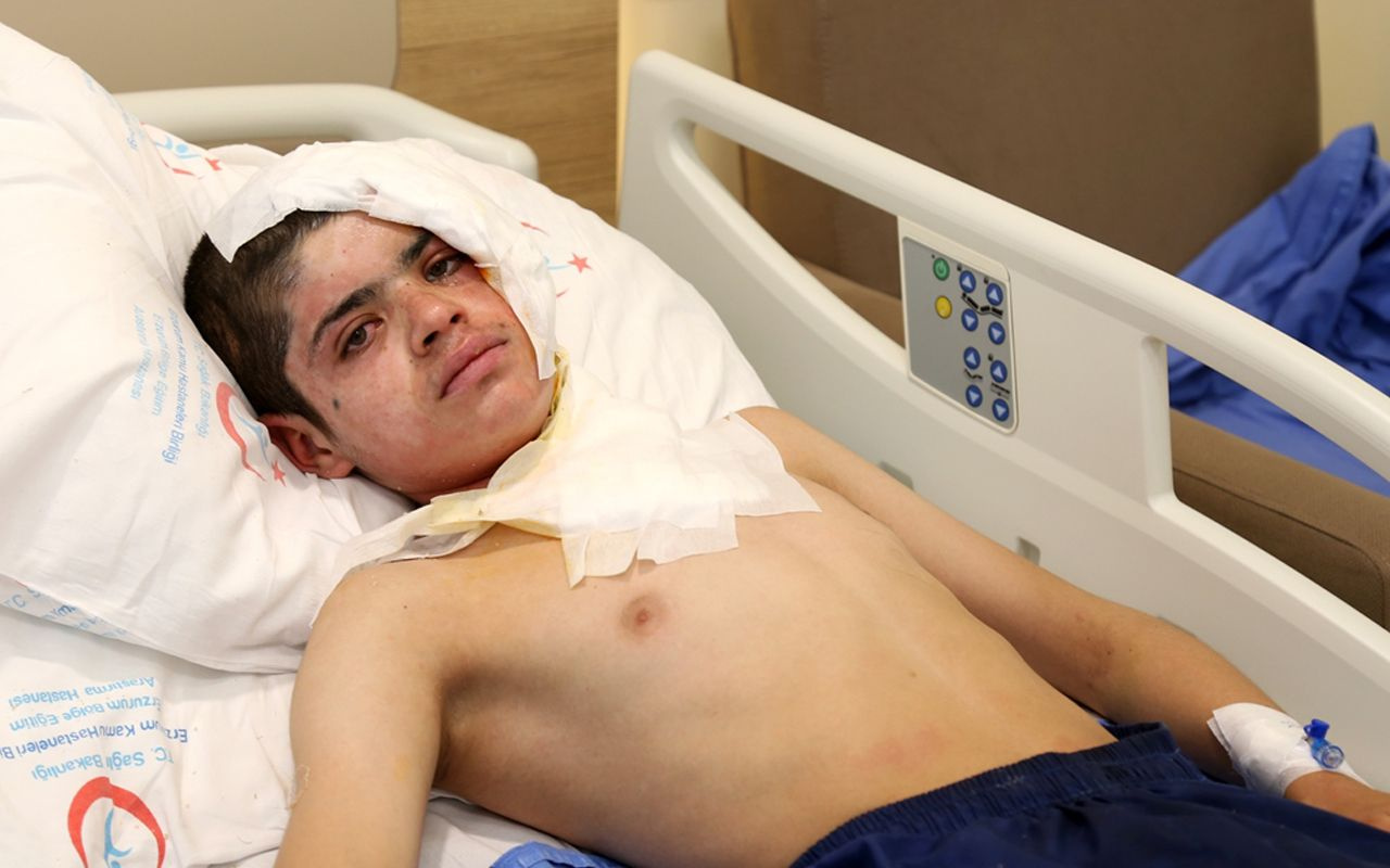 Kars'ta yüksek gerilim hattına kafasıyla temas etti feci şekilde yaralandı