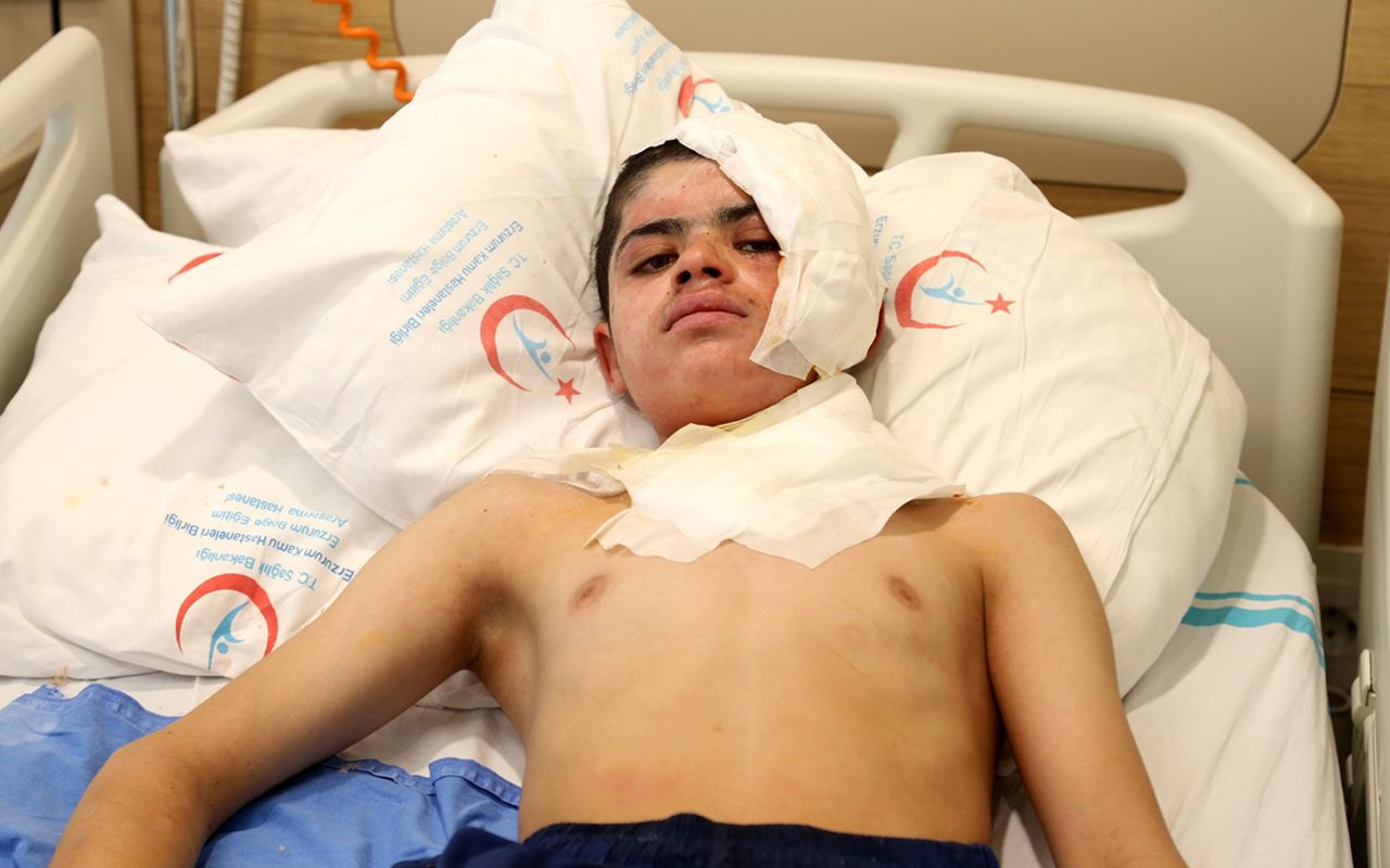 Kars'ta yüksek gerilim hattına kafasıyla temas etti feci şekilde yaralandı