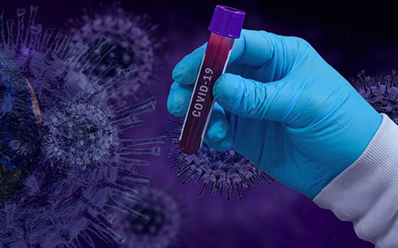 Dünya genelinde koronavirüs bilançosu! Can kaybı 784 bin 380’e yükseldi