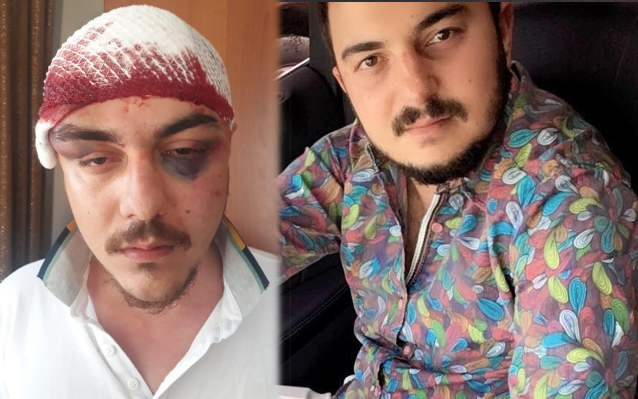 Mersin'de 4 kişi tarafından feci şekilde dövülüp komalık edildi