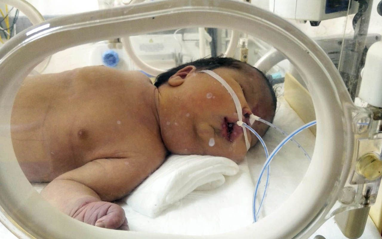 Gaziantep'te doğum raporunda erkek denen bebekleri kız çıktı