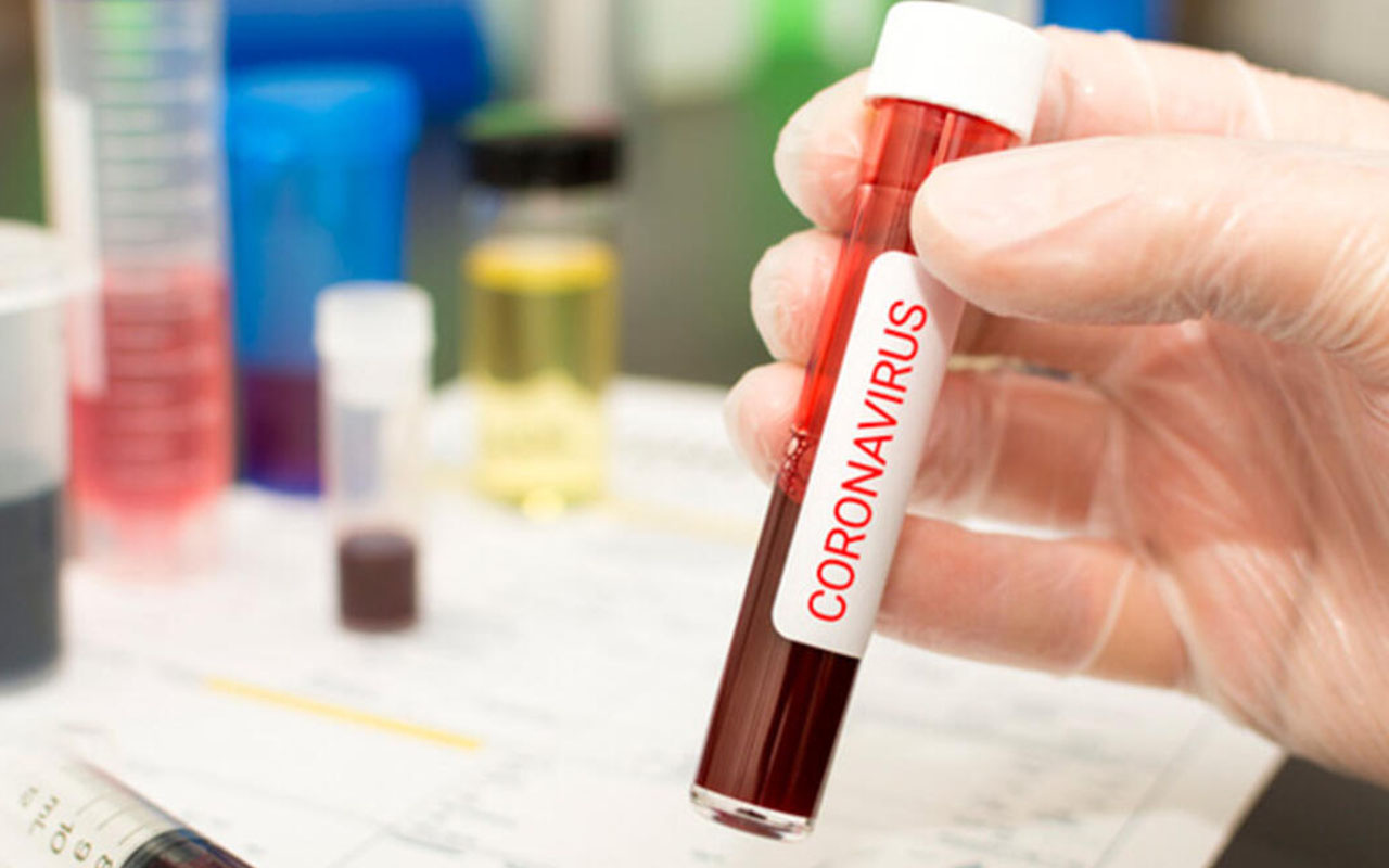 Koronavirüs ilacı deneylerde başarılı oldu! Şirketin hisselerini yarım günde yüzde 540 artırdı