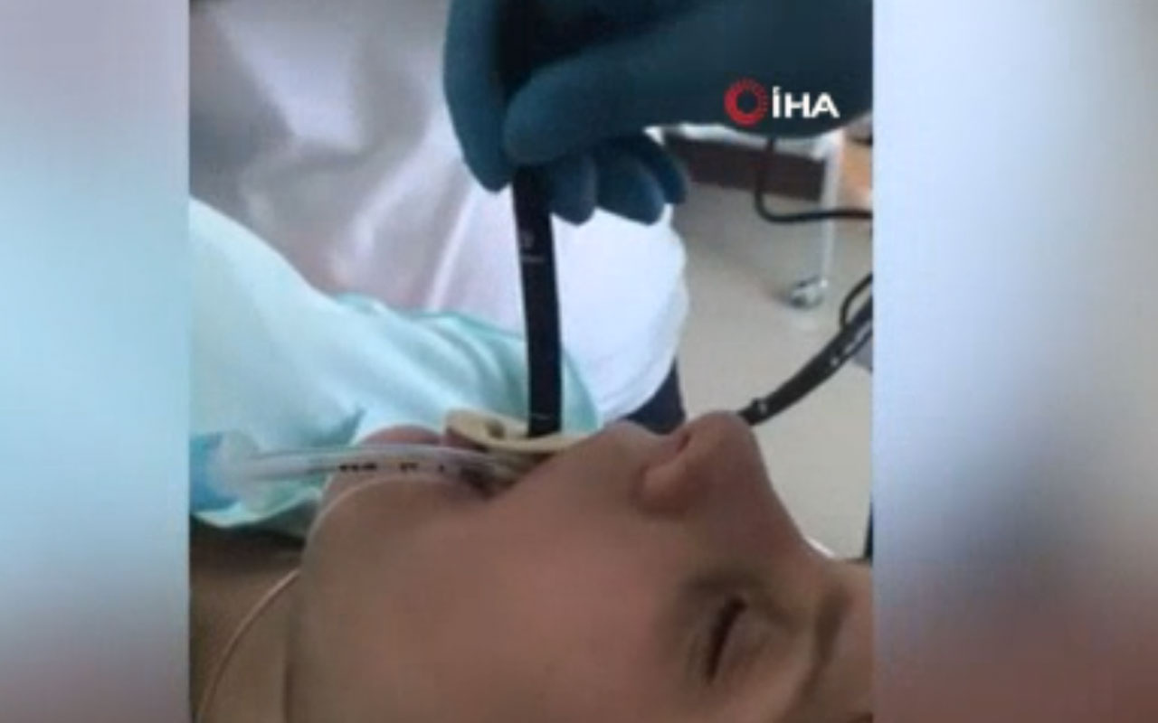 Rusya'da uyuyan kadının ağzından giren yılan ameliyatla çıkarıldı