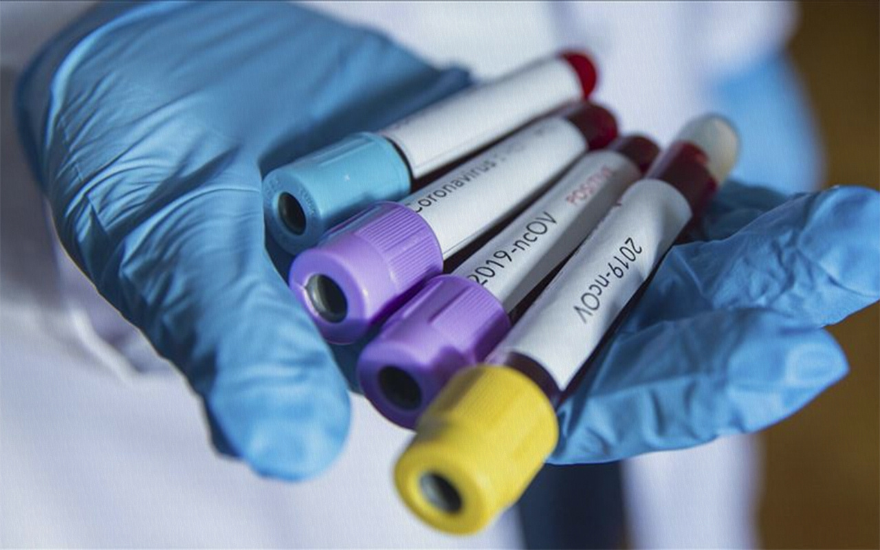 Erişte yaparken 8 kadın koronavirüse yakalandı