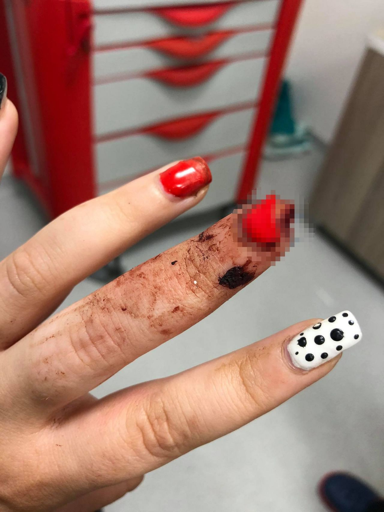 Sinop'ta akılalmaz olay genç kızın yemeğe gittiği köftecide parmağı koptu