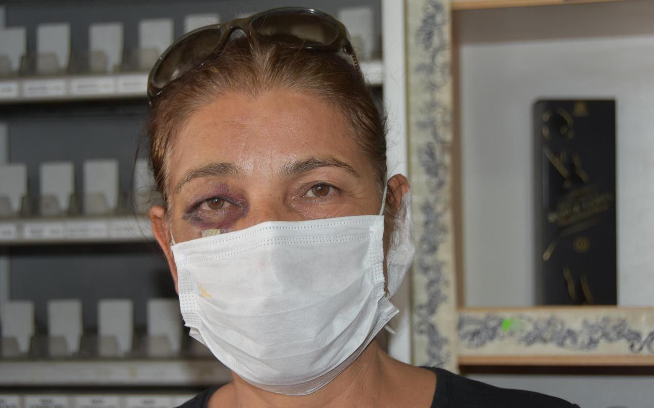 Muğla'da saldırıya uğrayan kadın büfeci: Bu adilerin yüzünden kapatıyorum