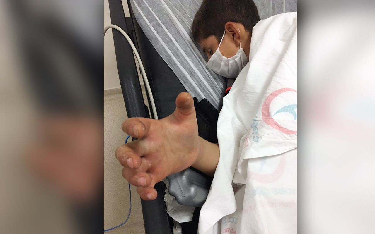 Şanlıurfa'da 13 yaşındaki Civan, engerek yılanı tarafından ısırıldı