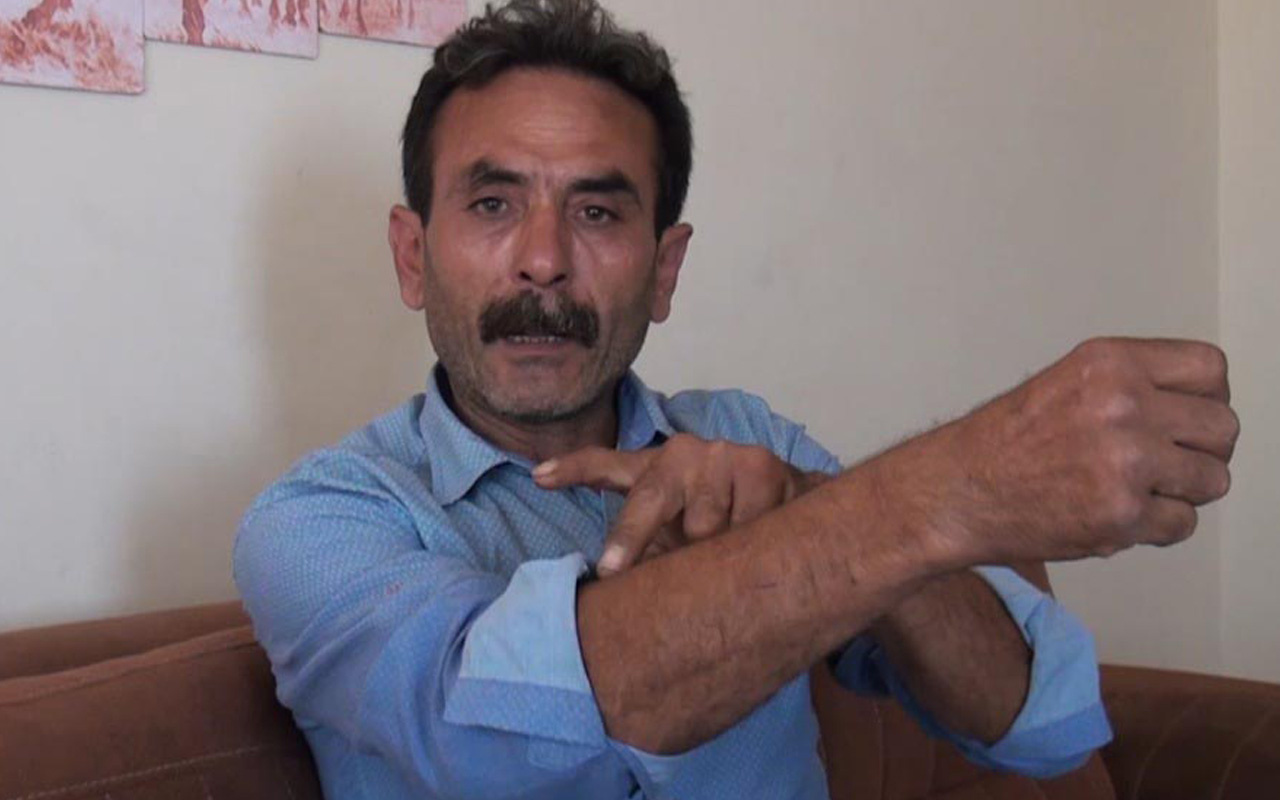 Aydın'da yaşadığı travmayı unutamıyor beslediği pitbull'un saldırdığı adam: Silahtan farkı yok