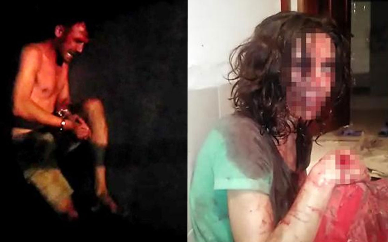 Alanya'da kocası tarafından öldüresiye dövülen kadını görenler dehşete kapıldı