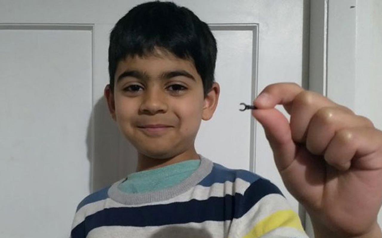 7 yaşındaki çocuğun burnuna kaçan Lego parçası 2 sene sonra düştü