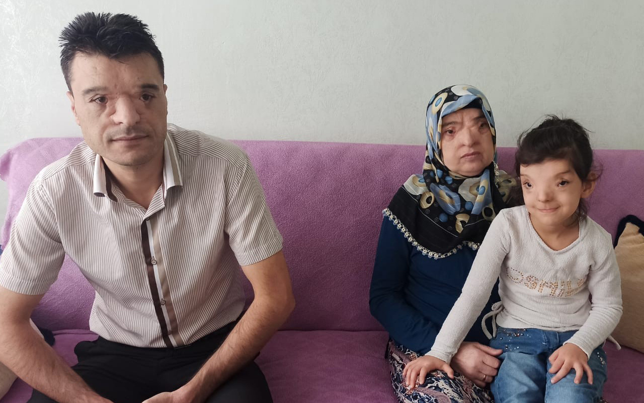 Bu hastalık dünyada sadece 4 ailede var! Malatyalı Yavuz ailesi gözleri açık uyuyor