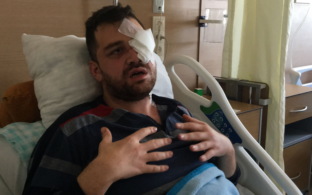 Konya'da bıçaklı saldırıya uğrayan avukat: Saldırgan peruk takmıştı