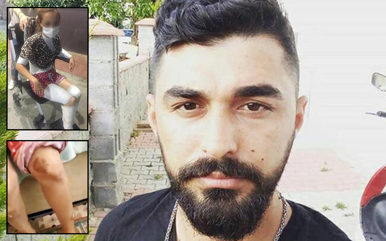 İstanbul'da kızgın bıçakla eşini yakıp zorla ilişkiye girdi! Anlattıkları kan dondurdu