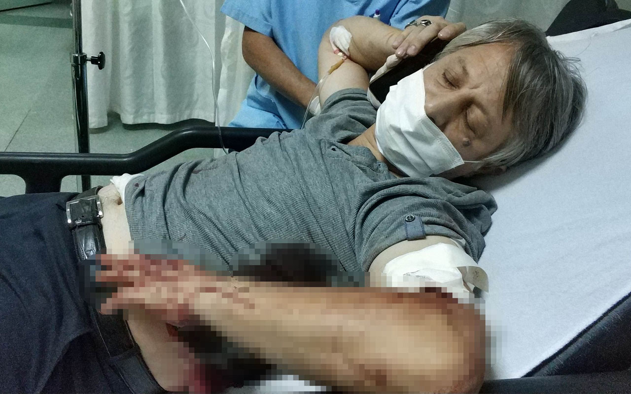Samsun'da evladın yaptığına bak: 16 yaşında babasını bıçaklayarak ağır yaraladı