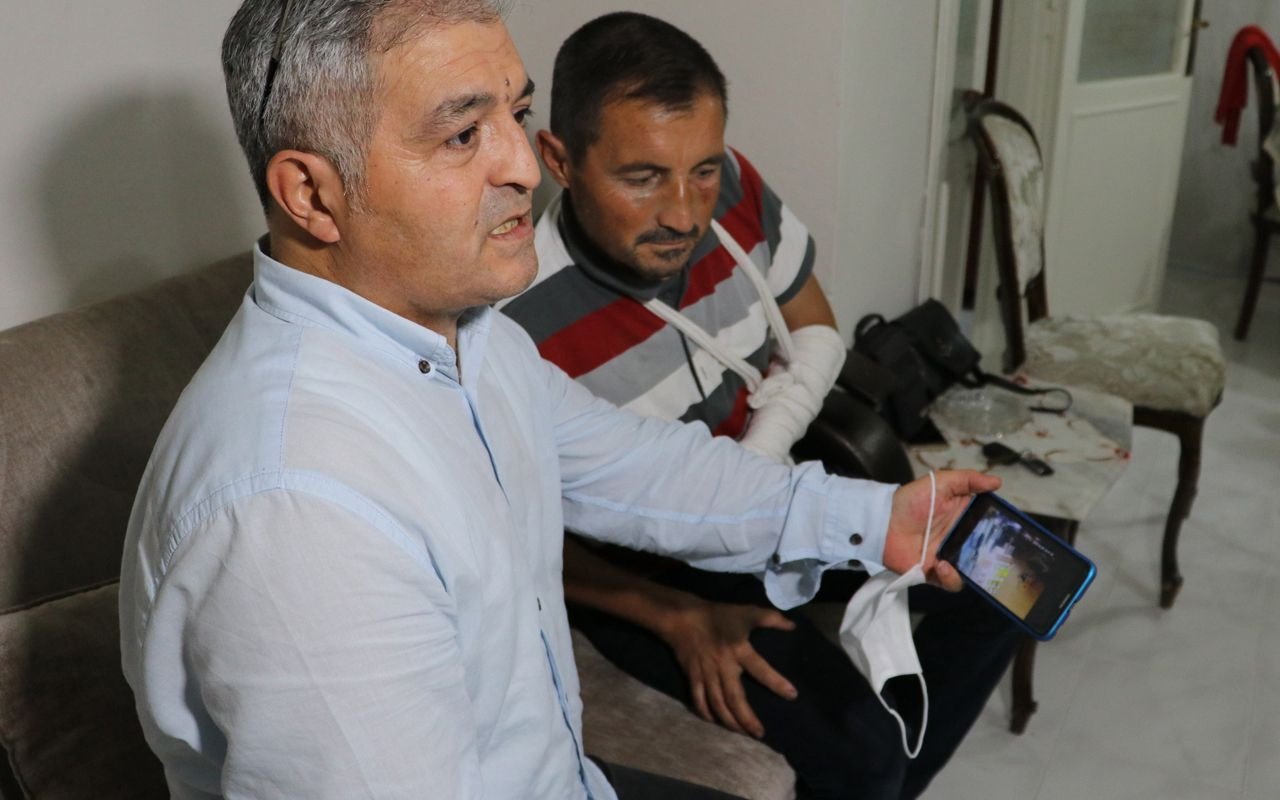 Adana'da işitme engelli adama korkunç saldırı! Burnu kırıldı ve kolu çatladı