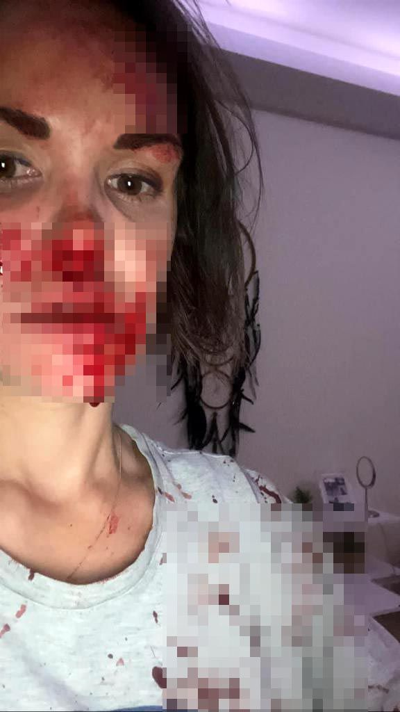 Ankara'da Rus eşe öldüresiye dayak terörü! Banyoya soktu kanlar içinde bıraktı