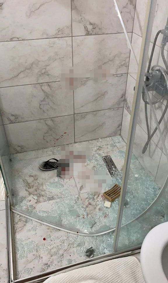 Ankara'da Rus eşe öldüresiye dayak terörü! Banyoya soktu kanlar içinde bıraktı