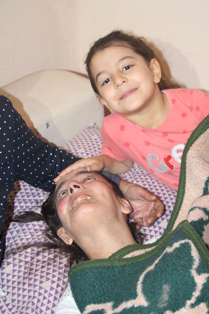 Adana'da damadı 'astım ilacı' diye verdi kızı tanınmaz hale geldi