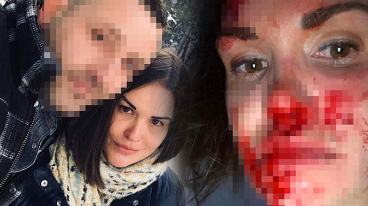Ankara'da kocasından şiddet gören Rus güzellik uzmanı evinde ölü bulundu