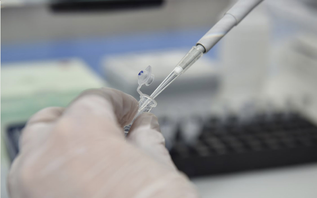 PCR testi nedir kimlere yapılır sonucu kaç güne çıkar?