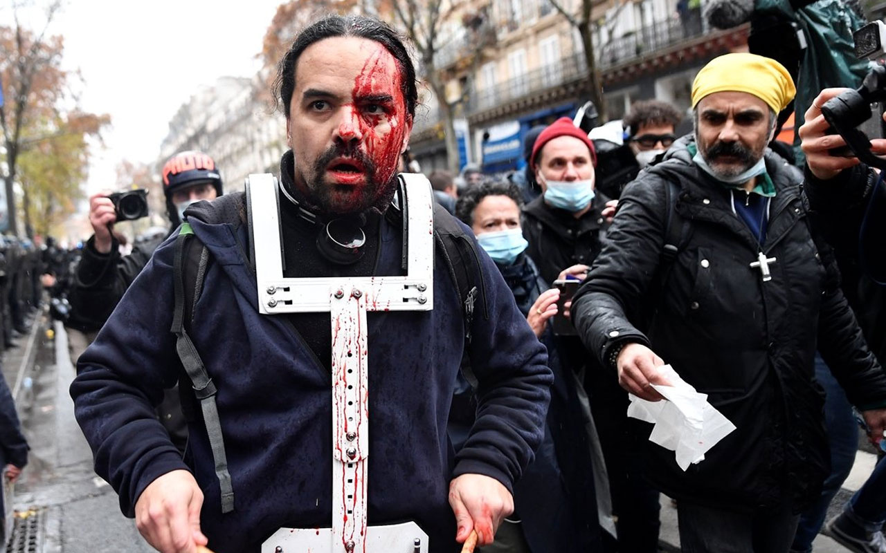 Fransız polisinin göstericilere müdahalesi endişe yarattı