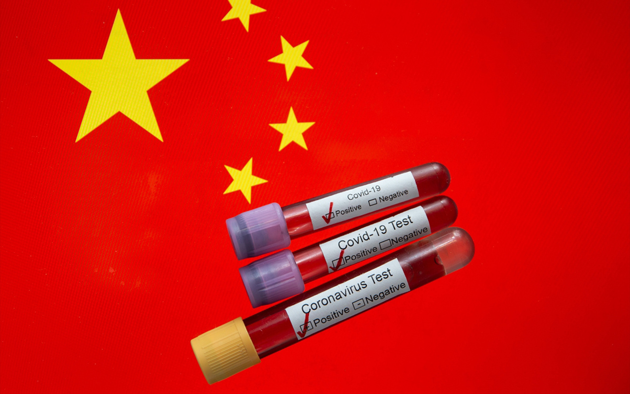 Koronavirüsün çıktığı ülke Çin'den çok tartışılacak DSÖ kararı
