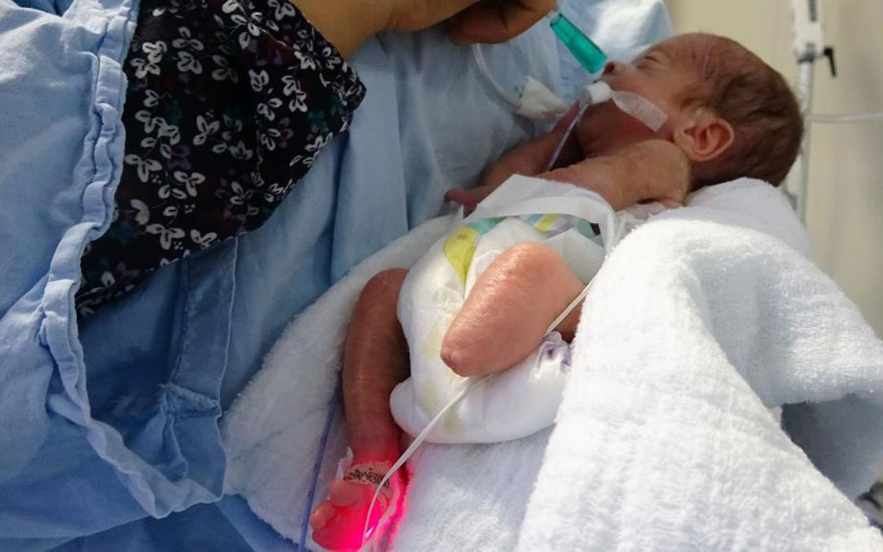 Tokat'ta parmak bebek ayaksız olarak dünyaya geldi hayata tutundu