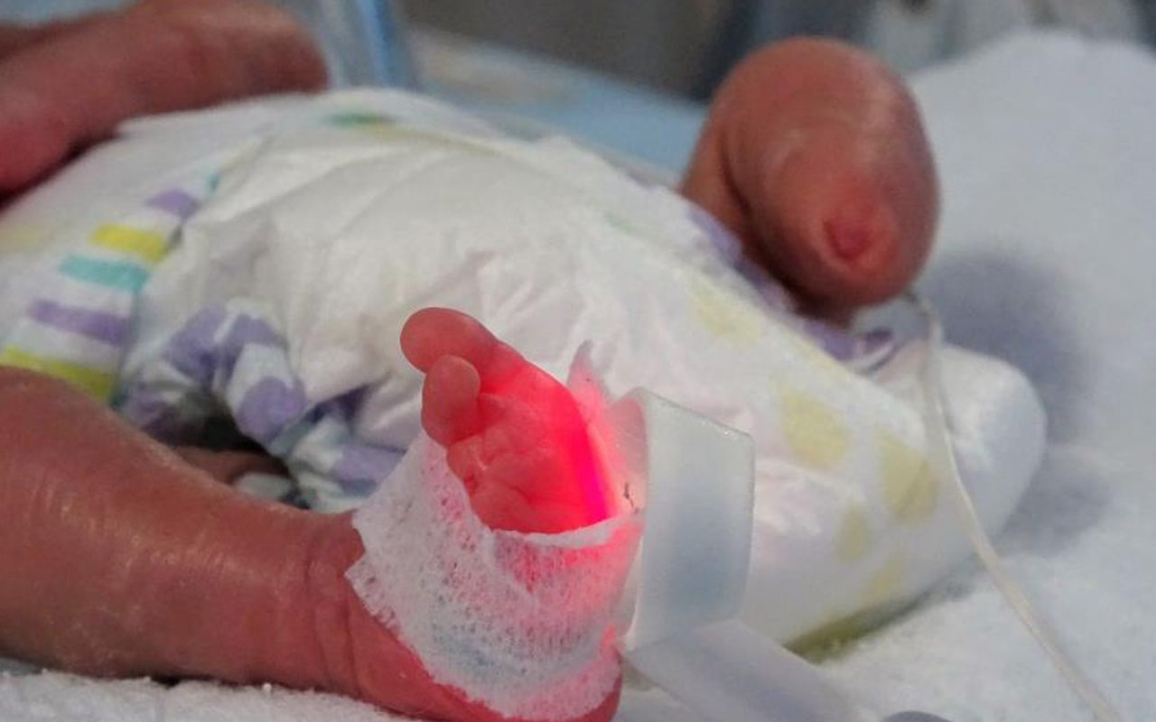 Tokat'ta parmak bebek ayaksız olarak dünyaya geldi hayata tutundu
