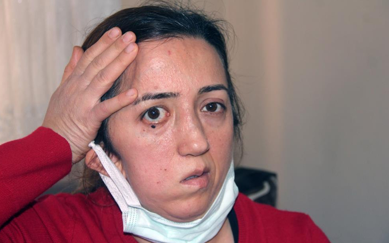Antalya'da boyun ağrısıyla gitti ameliyat oldu! Giresunlu hemşire hayatının şokunu yaşadı