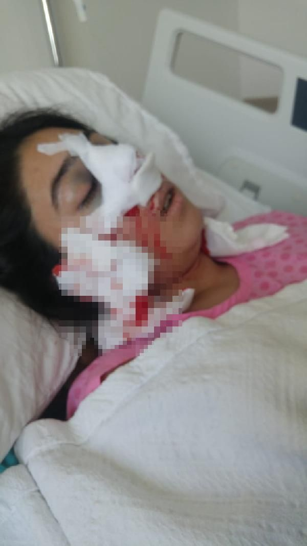 Adana'da burun estetiği sonrası ölen Leyla’nın ses kaydı ortaya çıktı: Ağzımdan, burnumdan kan geliyor