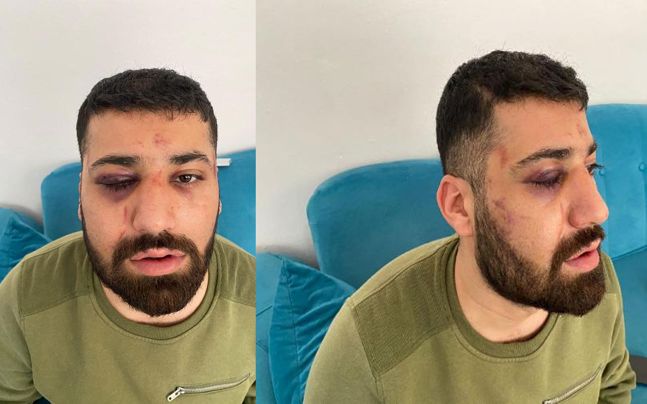 İstanbul'da 'polis dövdü' dedi nezarethane görüntüleri foyasını ortaya çıkardı