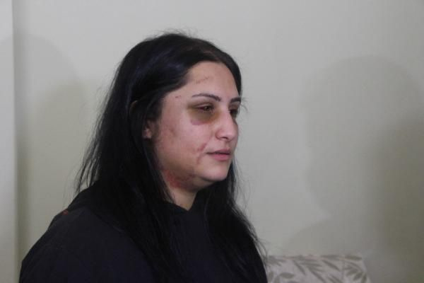 Samsun'da sokakta eşinin dövdüğü kadın konuştu: Kızım 'babamı istemiyorum' diyor