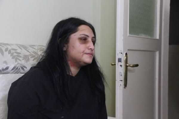Samsun'da sokakta eşinin dövdüğü kadın konuştu: Kızım 'babamı istemiyorum' diyor