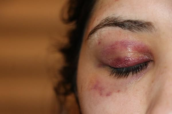 Karabük'te kadına şiddet! Gece saldırdı sabah 'Pide yaptırayım mı?' diye mesaj attı