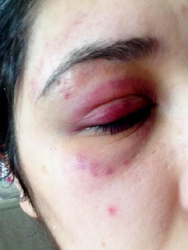Karabük'te kadına şiddet! Gece saldırdı sabah 'Pide yaptırayım mı?' diye mesaj attı